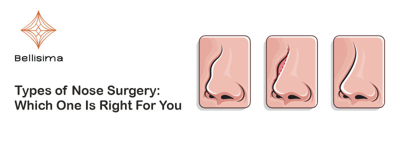 nose surgery in Ahmedabad
