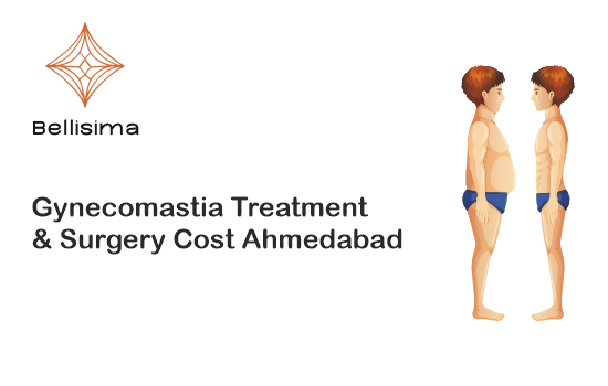 Gynecomastia surgery cost in Ahmedabad