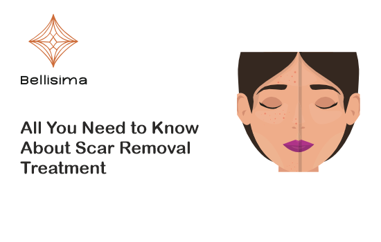 Scar Removal Treatment