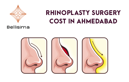 Rhinoplasty Cost in Ahmedabad
